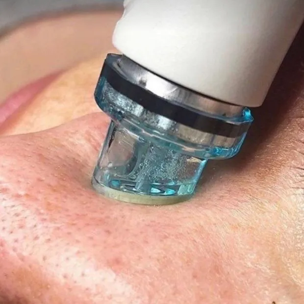 Hydra Deep Cleansing Facial — Crown of Beauty